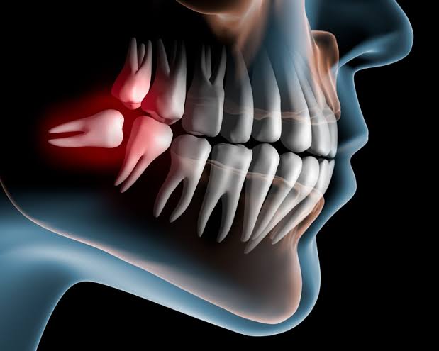 Cirurgia Oral