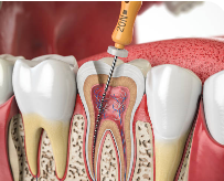 Endodontia
